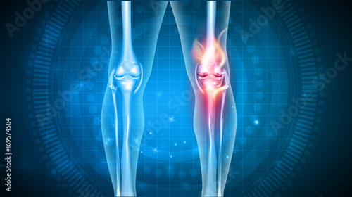 Joint problems bright abstract design, burning damaged knee 