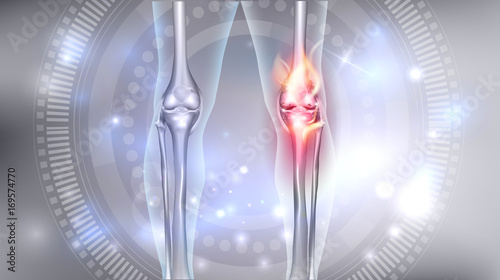 Joint problems bright abstract design, burning damaged knee 