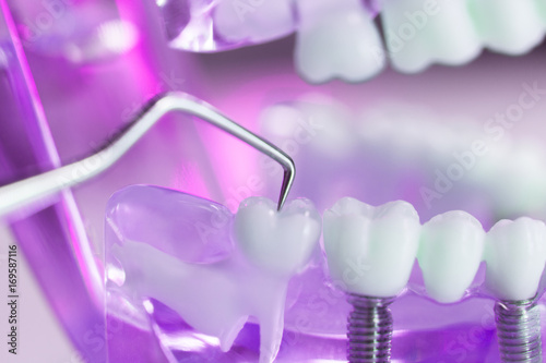 Fototapeta Naklejka Na Ścianę i Meble -  Dental teeth dentist model