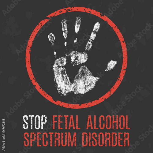 Vector illustration. The medical diagnosis. Stop fetal alcohol spectrum disorder.