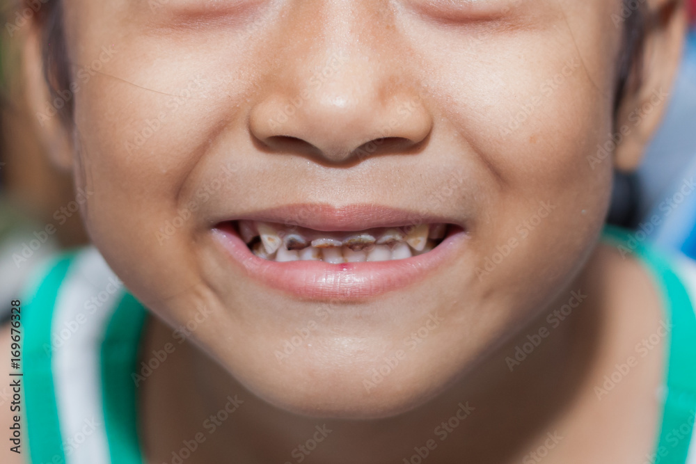 Fototapeta premium Smiling child