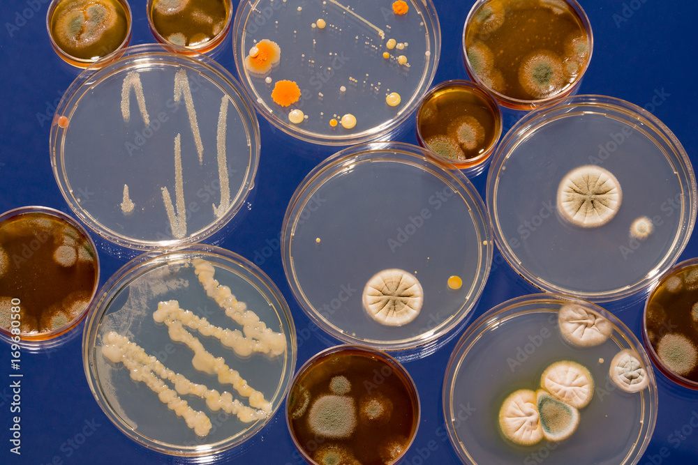 A petri dish with growing cultures of fungi and
