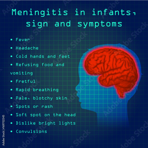 Meningitis in infants, signs and symptoms. Vector medical illustration. Kid, baby, childhood. Dark blue science background, blue silhouette of child head, anatomy image of brain.