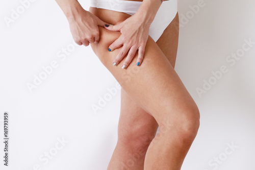 Cellulite fat removal skin. Young woman watches the weight body.