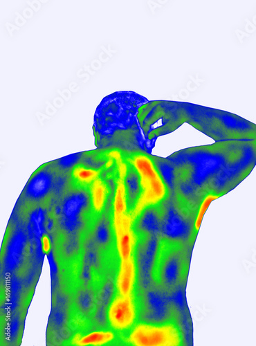 Thermal imaging men's back