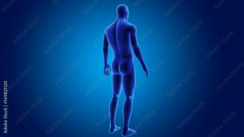 Patella with Body Patella with Body