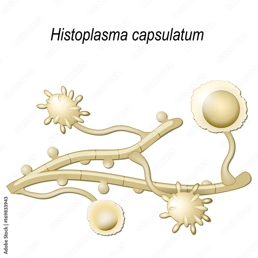Histoplasma capsulatum Stock Vector Adobe Stock