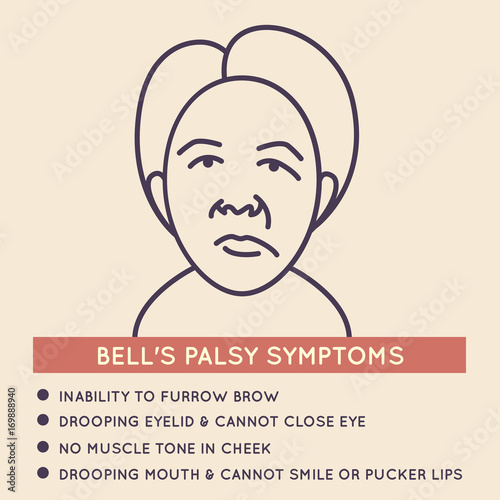 bell's palsy vector icon illustration