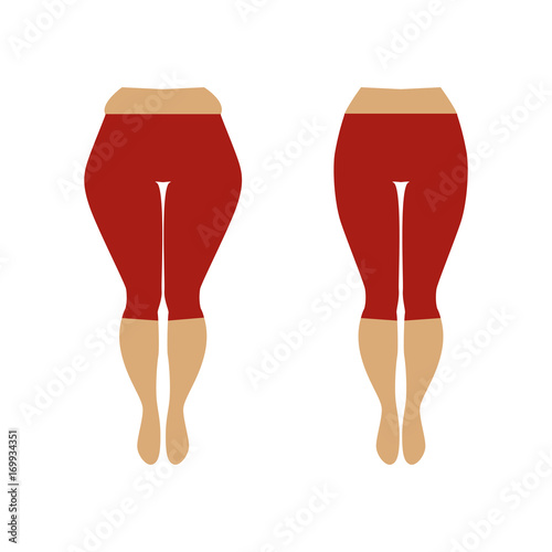 Fat and slim womans hip. Illustration of a woman with cellulite and smooth skin.  Weight loss concept