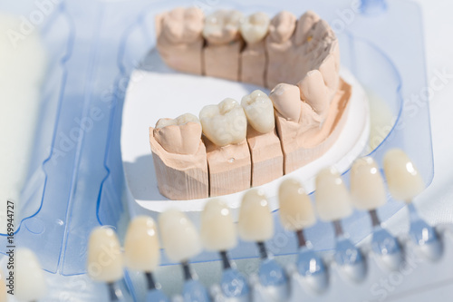 Prothesensattel mit Zahnersatz im Zahnlabor wird farblich abgeglichen