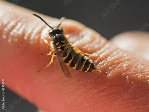 striped angry wasp stuck in pain sharp sting in the finger man