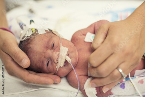 Newborn premature baby in the NICU intensive care 