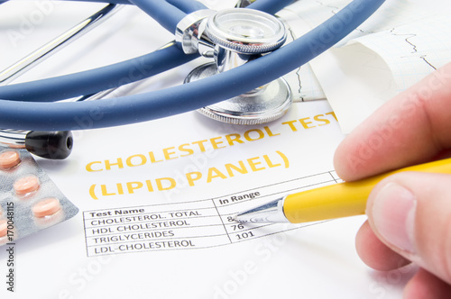 General practitioner checks cholesterol levels in patient test results on blood lipids. Statin pills, stethoscope, cholesterol test and hand of doctor, pointing to increasing its level in concept