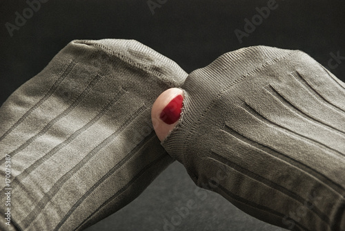 Toe Sticking Out of Hole in Sock