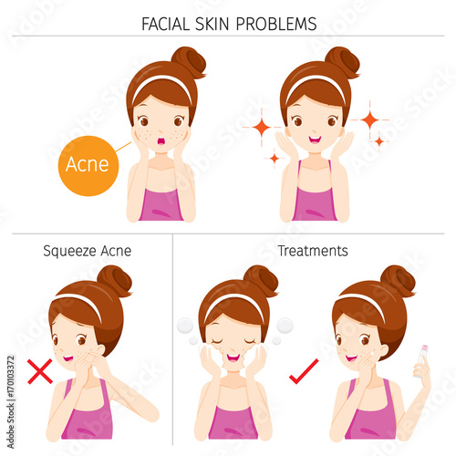Girl With Acne, Facial Skin Problems And Treatment, Facial, Beauty, Cosmetic, Makeup, Treatment, Healthy