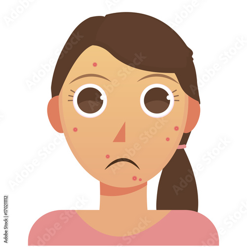 Woman with acne