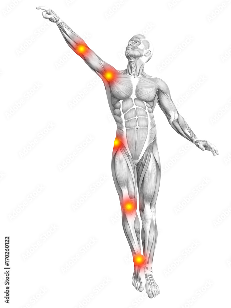 Conceptual human muscle anatomy with red and yellow hot spot inflammation or articular joint pain for health care therapy or sport concepts. 3D illustration man arthritis or bone osteoporosis disease Conceptual human muscle anatomy with red and yellow hot spot inflammation or articular joint pain for health care therapy or sport concepts. 3D illustration man arthritis or bone osteoporosis disease