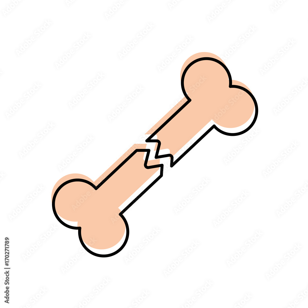 bone fracture human body xray concept icon vector illustration bone fracture human body xray concept icon vector illustration