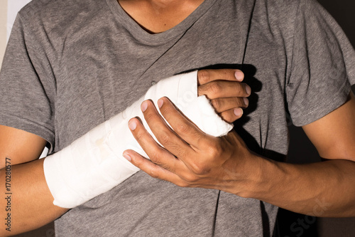 broken arm