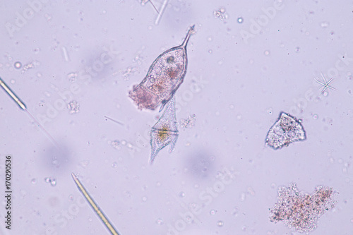 Ceratium/Dinoflagellate (Protozoa) under microscope. photo
