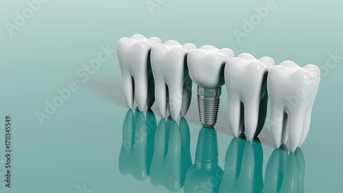 Teeth isolated on green background. 3d illustration photo