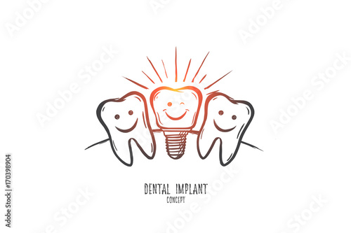 Dental implant concept. Hand drawn dental implant model. Implant tooth isolated vector illustration.