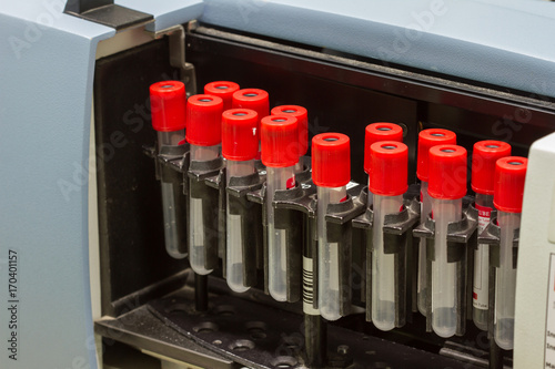 medical blood separation test centrifuge