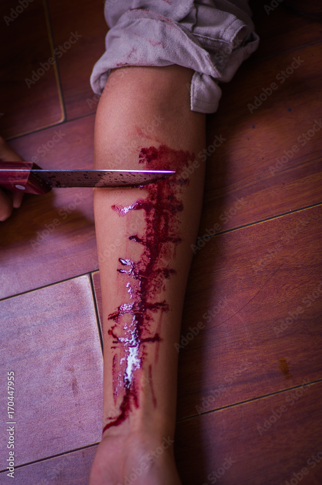 real bleeding arm