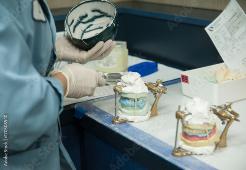 Pepraring Denture 