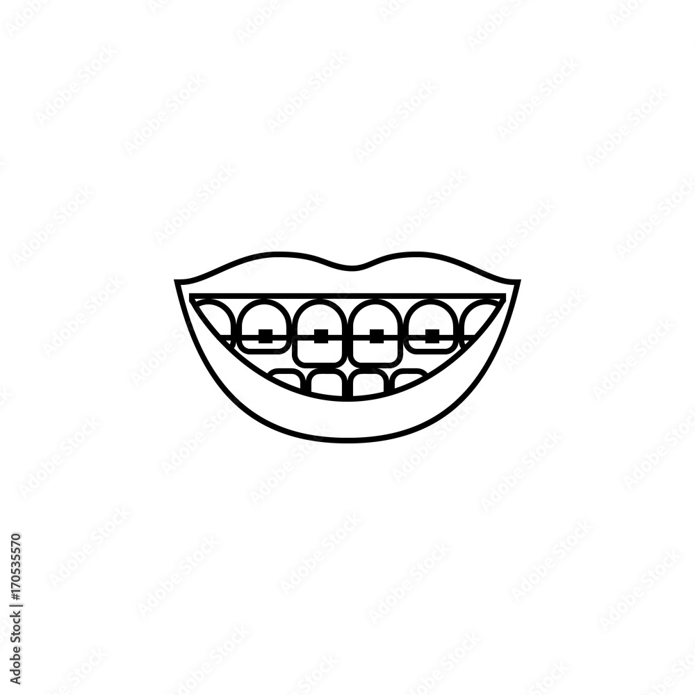 Smiling female lips with braces. Vector line icon isolated on white background. Smiling female lips with braces. Vector line icon isolated on white background.