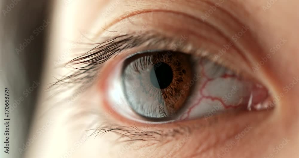 Woman red blood eye