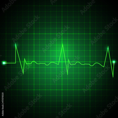 Heart pulse graphic. Ekg line on green background. Cardiogram background. Vector illustration