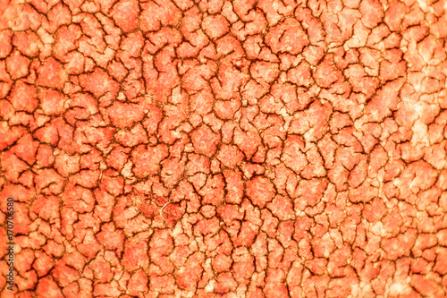 Solidified coagulated blood seen on a 100x microscope view. Blood smear under microscope present neutrophils and red blood cells