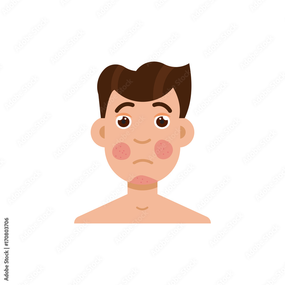 Psoriasis or rosacea men face. Vector illustration. Psoriasis or rosacea men face. Vector illustration.