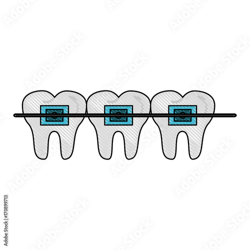 Odontology dental braces icon vector illustration graphic design