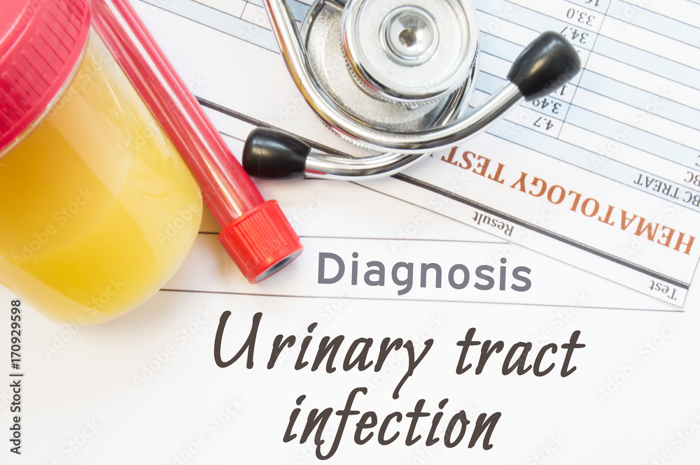 Urinary tract infection diagnosis. Lab container with urine sample