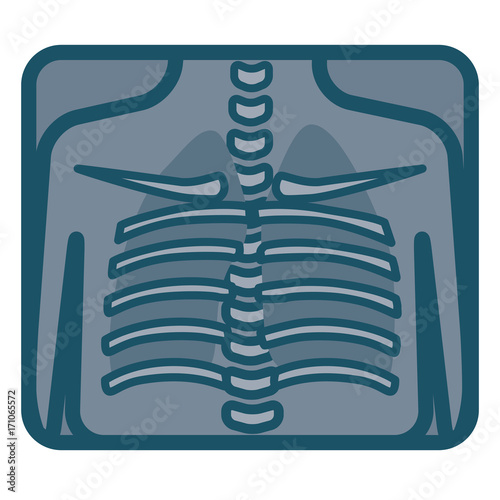 Human lungs xray image. Vector illustration.