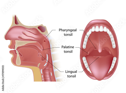 Tonsils in open mouth and sagittal view photo