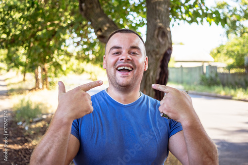 Young man in a blue T-shirt with a chipped tooth