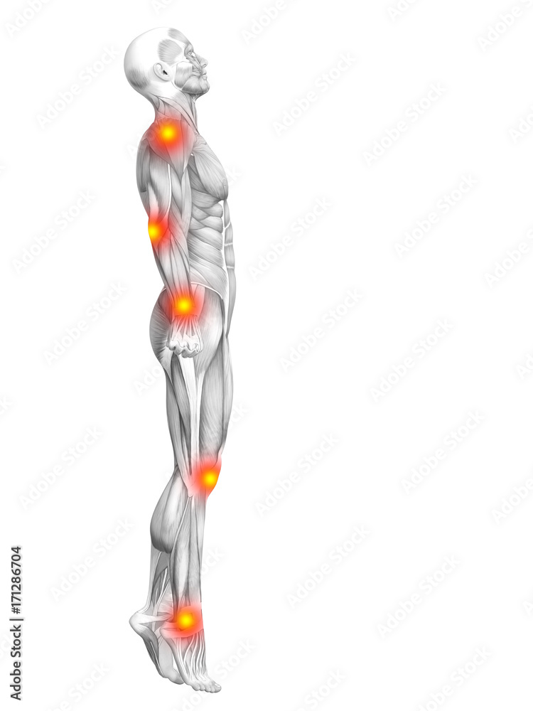 Conceptual human muscle anatomy with red and yellow hot spot inflammation or articular joint pain for health care therapy or sport concepts. 3D illustration man arthritis or bone osteoporosis disease Conceptual human muscle anatomy with red and yellow hot spot inflammation or articular joint pain for health care therapy or sport concepts. 3D illustration man arthritis or bone osteoporosis disease