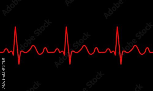 heartbeat icon. ECG Pathology Trace, Vector illustration.