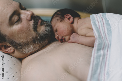 Skin on skin bonding
