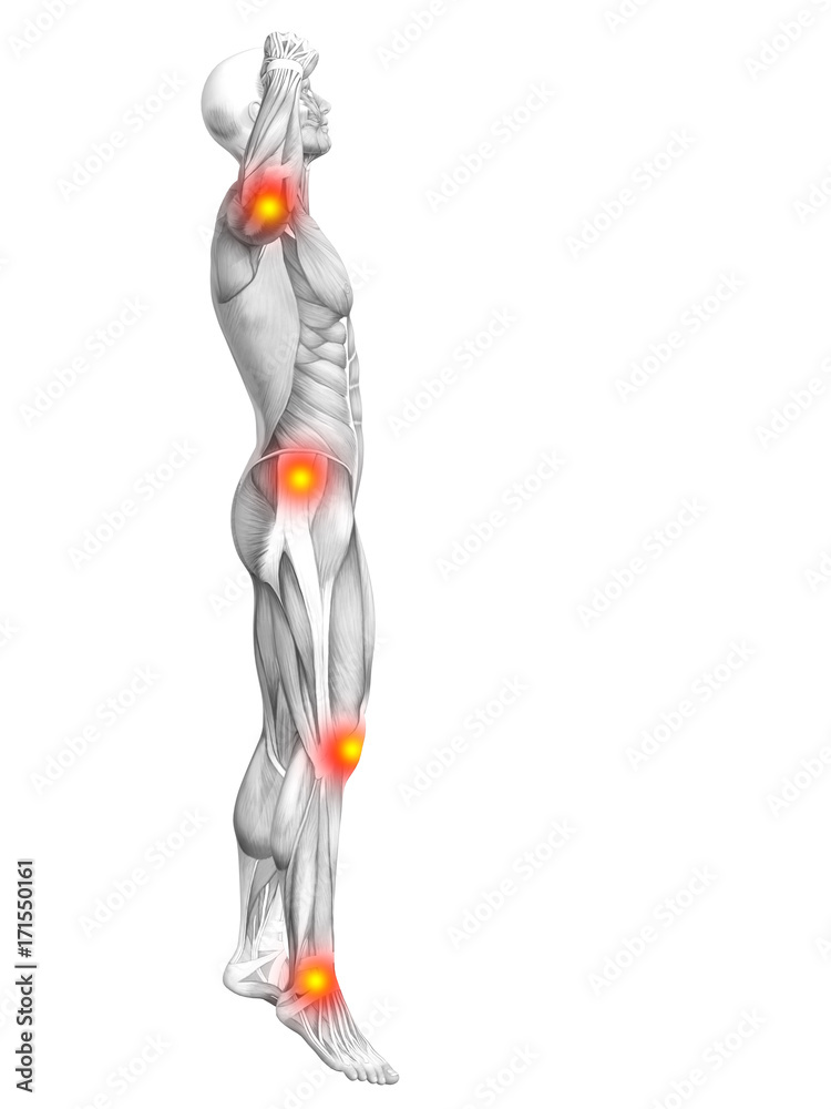 Conceptual human muscle anatomy with red and yellow hot spot inflammation or articular joint pain for health care therapy or sport concepts. 3D illustration man arthritis or bone osteoporosis disease Conceptual human muscle anatomy with red and yellow hot spot inflammation or articular joint pain for health care therapy or sport concepts. 3D illustration man arthritis or bone osteoporosis disease