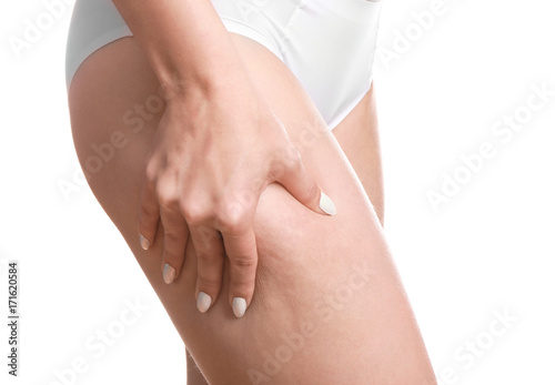 Woman with cellulite problem on white background © Africa Studio