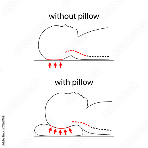 Illustration of spine line when baby sleeps on normal pillow and healthy pillow.