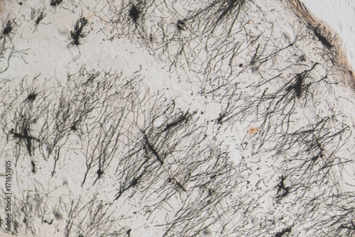 Close-up of rat's nerve cell photo