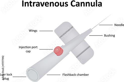 Intravenous Cannula photo