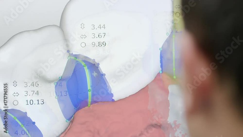 A man creates on the computer a model of the future prosthesis of teeth made on automatic process dental milling machine.