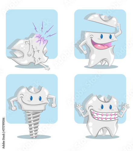 Four cartoon illustrations of a tooth: implant, crown, orthodontics and decay. 