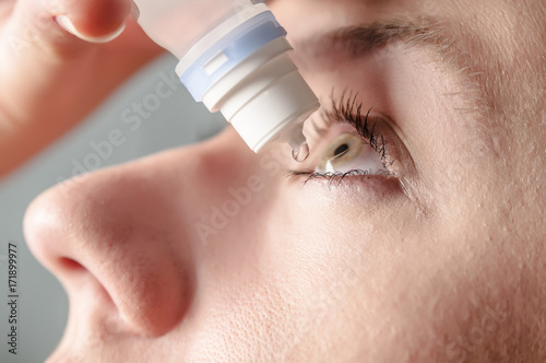Close up view of young woman applying eye drop to left eye, artificial tears, antibiotics, antihistamine.